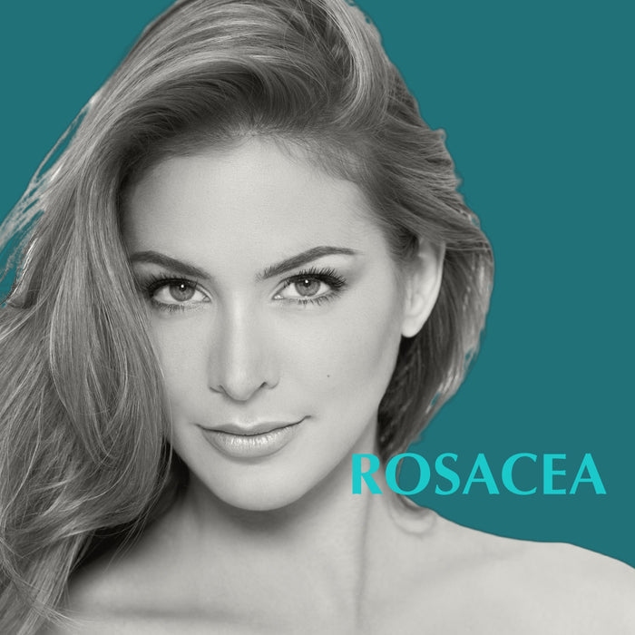 Rosacea - MD Aesthetics