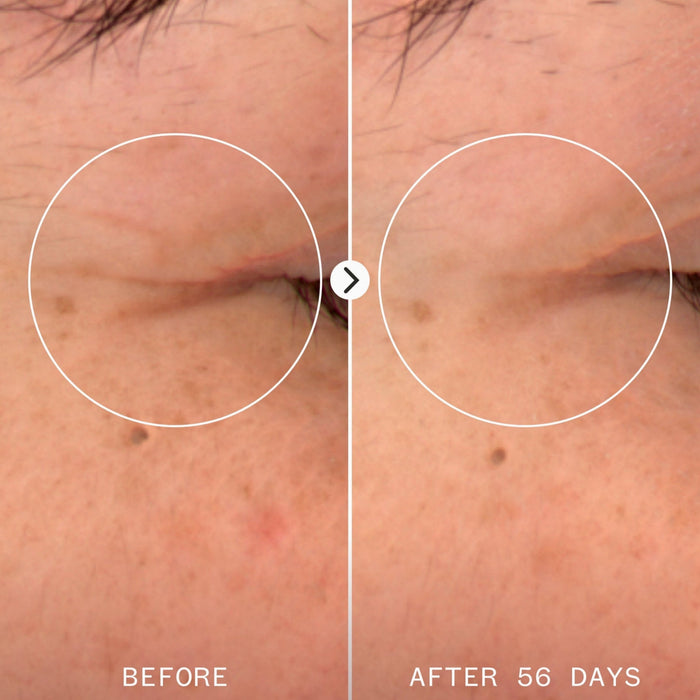 Pai Skincare-Age Confidence Nad & Tri Peptide Renewal Serum-Skincare-5060139729826_1920x2496_BEFORE_AFTER-The Detox Market |