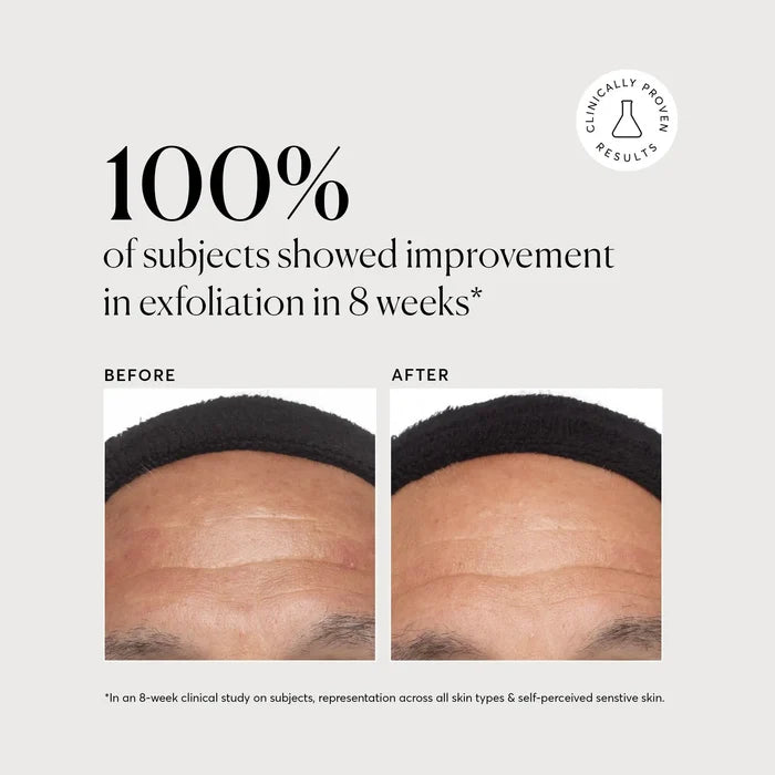 Azelaic Acid Derivative Complex 10% - Jumbo