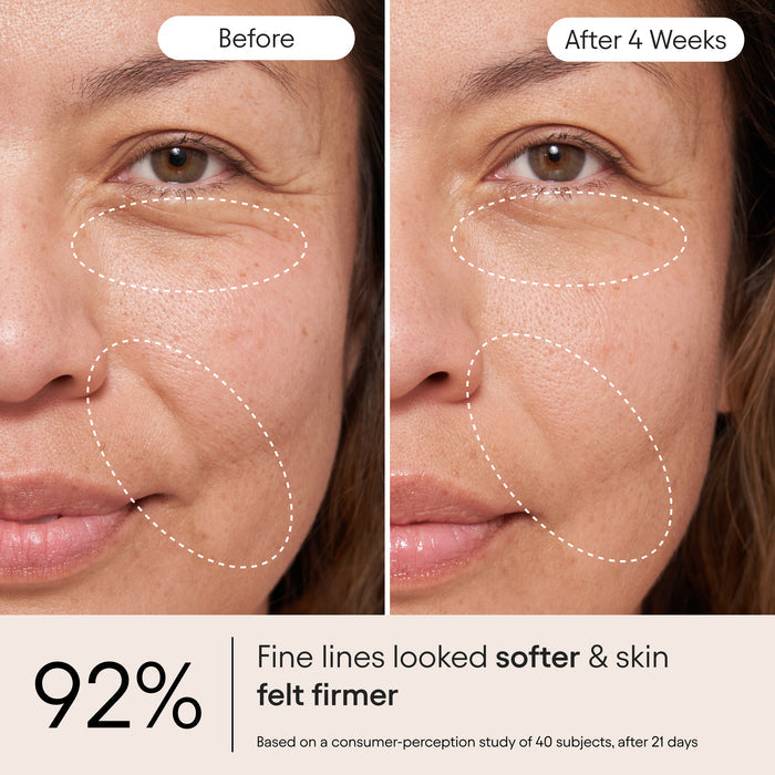 Alpyn Beauty-Barrier Repair Cream-Skincare-BarrierRepair3-The Detox Market |