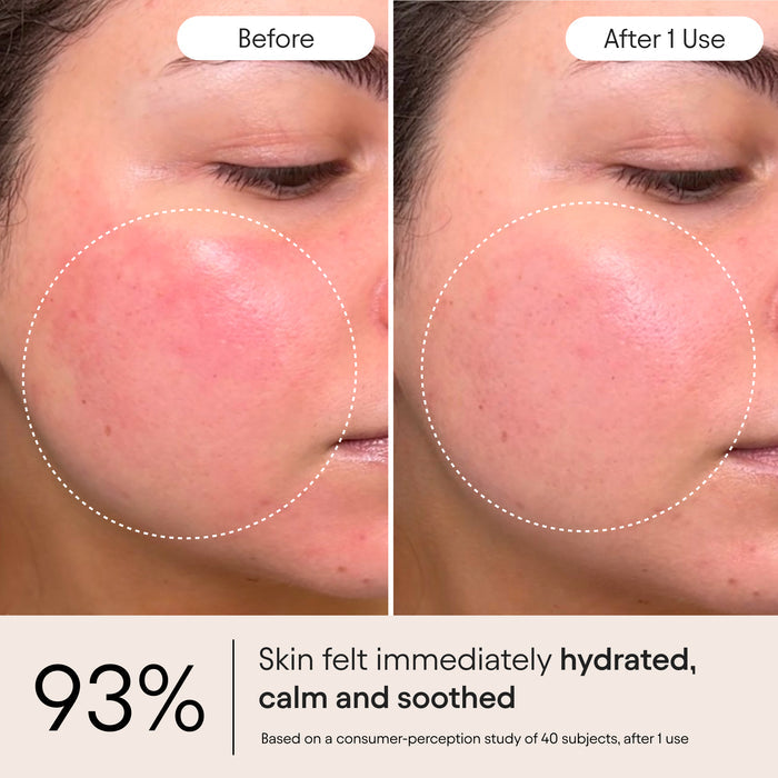 Alpyn Beauty-Barrier Repair Cream-Skincare-BarrierRepair4-The Detox Market |