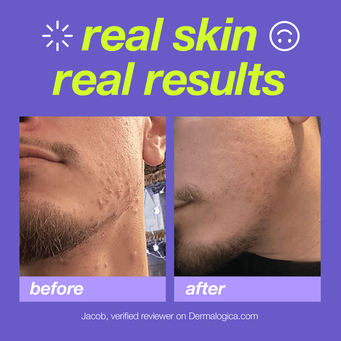 breakout clearing foaming wash