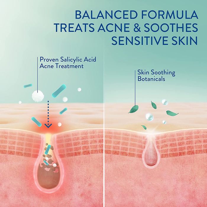 CLEARASIL Stubborn Acne Control 5 In 1 Spot Treatment Cream كريم موضعي لعلاج حبوب البشرة