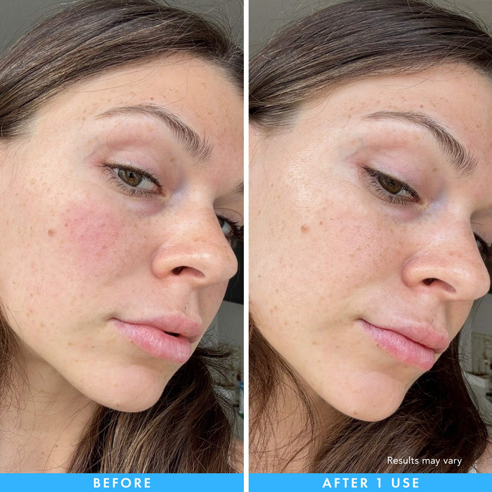 Cryo + Soothing Hydrogel Mask