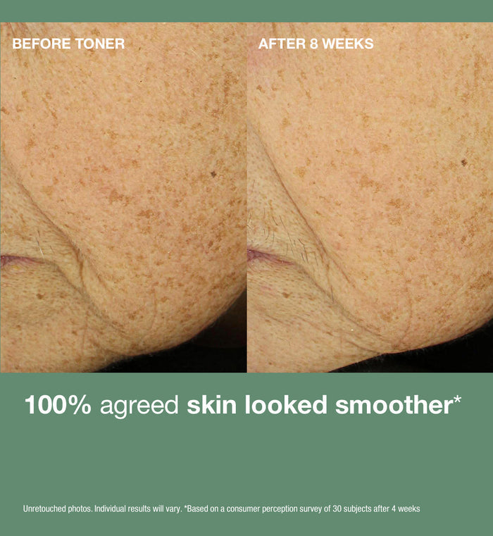 Daily Reveal® Retexturizing Toner
