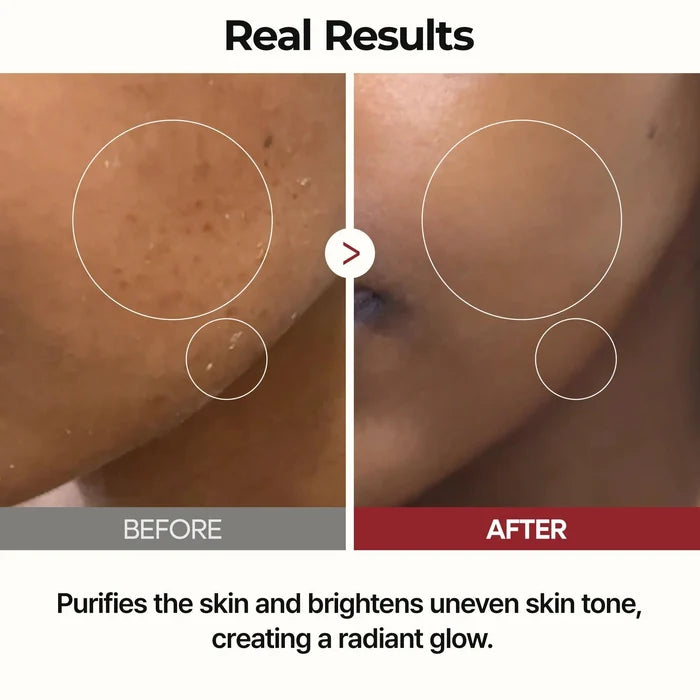 Dr.Melaxin Peel Shot Glow Rice Toner 200 mL