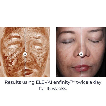 Enfinity Serum