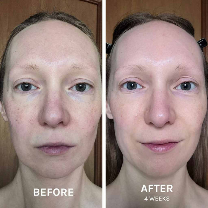 Evolve EGF + Collagen Renewal Booster 15 ml, tuotekuva