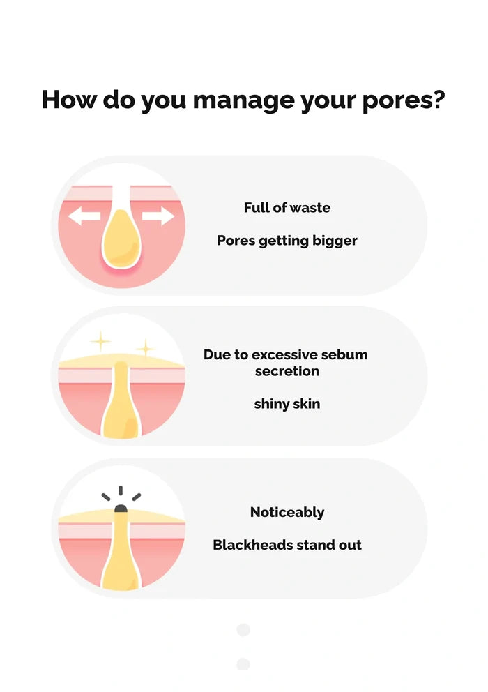 Diagram showing different skin conditions related to pores on a white background