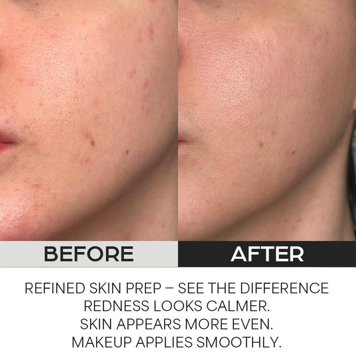 House of Hur Clearing Skin Prep Essence Pad 70 pads