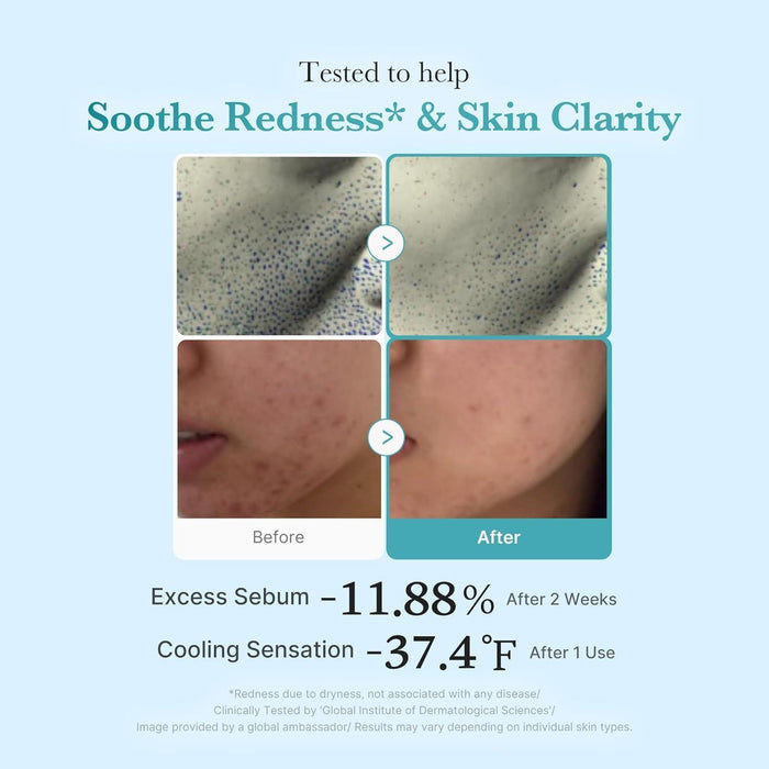 Medicube Azelaic Acid Niacinamide Clear Cleansing Toner With 4% Azelaic Acid 250 mL