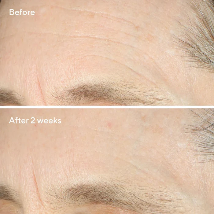 Murad Intense Recovery Cream