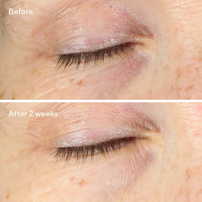 Murad Vita-C Eyes Dark Circle Corrector