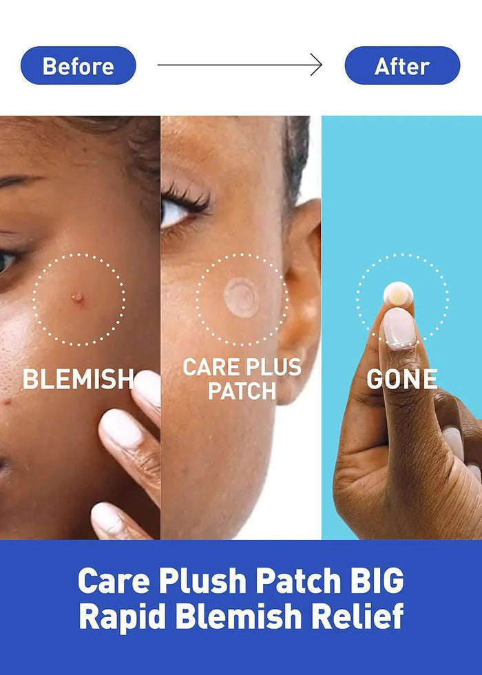 Olive Young Care Plus Spot Cover Patch Calming 96 pcs