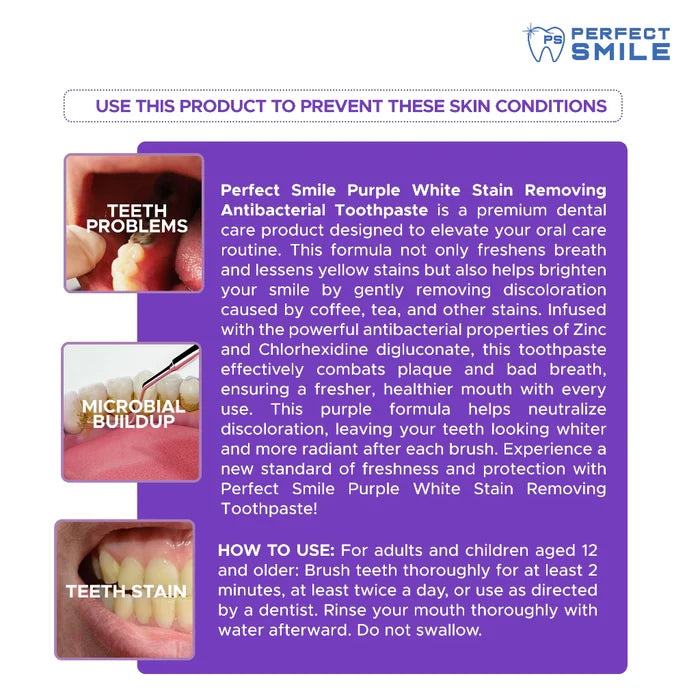 Perfect Smile Purple White Stain Removing Toothpaste 100ml Value Pack 2pcs