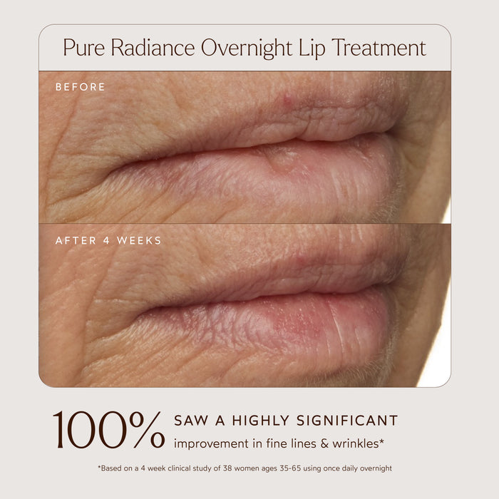 True Botanicals-Pure Radiance Overnight Lip Treatment-Skincare-S-W-D-LP01-R_3_65d5077f-bfc1-4c20-8a59-51fe50c3335e-The Detox Market |