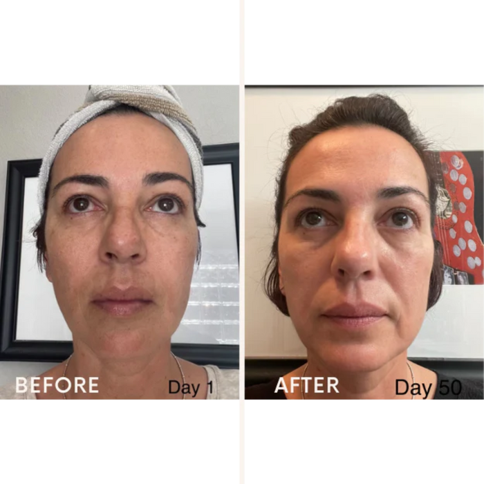Skincare Junkie Discoloration Fade Wand