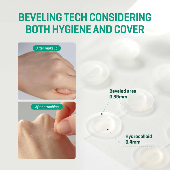 SOME BY MI 30 Days Miracle Clear Spot Patch 18 pcs