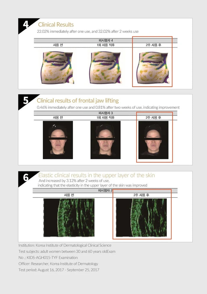 Clinical results of a skincare product with before-and-after images on a white background.